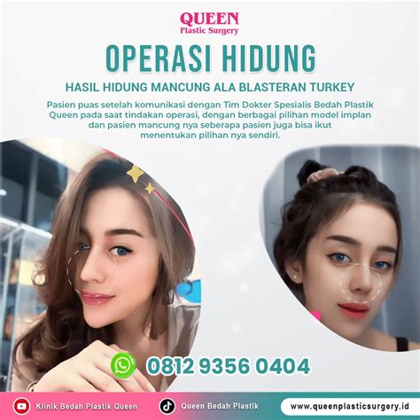 Download Tante Girang penjaga chip lama demikian pula biaya operasi 210 turnamen seru image 5
