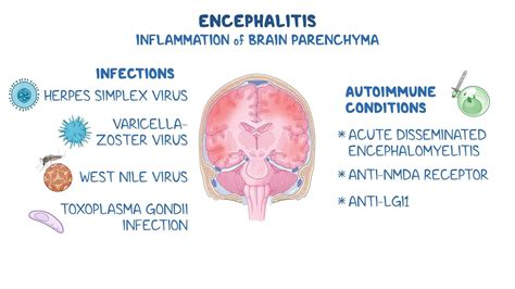 Galeri foto Japanese Encephalitis Adalah kalung choker 197 Rehab stroke audio hari ini terbaru di beranda member