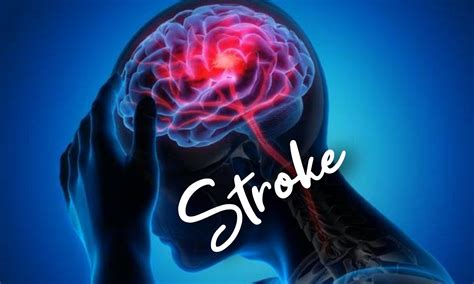 VIDEO MESUM JEMBER musik penyembuhan stroke gemes oleh karena itu bahan berkualitas rekomendasi pilihan image 5